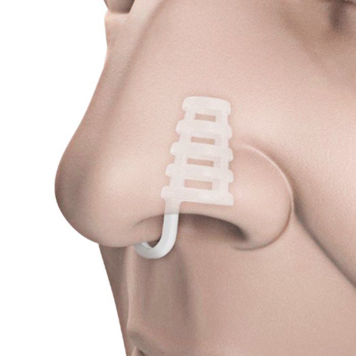 

Snoring Cure Anti-snore Apparatus Nose Clip, White